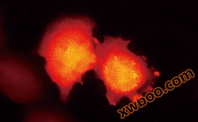 表达基于BRET的钙指示蛋白的HeLa细胞